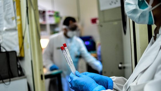 اقليم شيشاوة : تسجيل حالتين إضافيتين وحصيلة المصابين بفيروس كورونا ترتفع الى 128 بالإقليم .