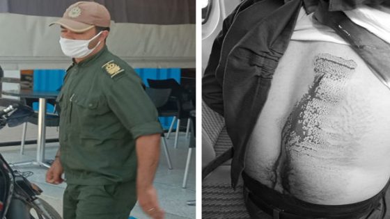 اعتداء على قائد قيادة سيدي موسى بن علي بالمحمدية يثير الجدل