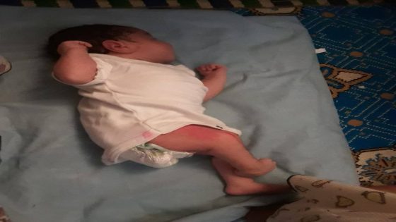 طفلة في شهرها الأول تصارع المرض… باب أملها بين أيديكم.