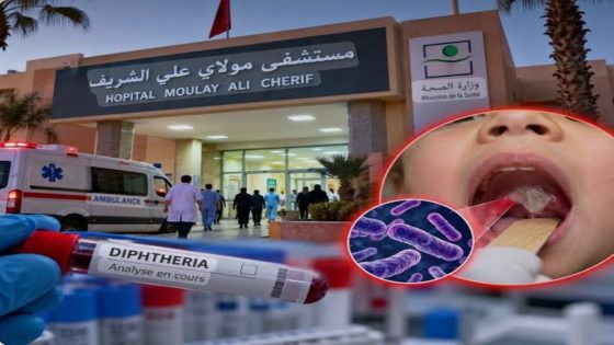 فاجعة بالسعيدية: وفاة طفل بمرض الدفتيريا الخناق تثير ناقوس الخطر حول الوضع الصحي.